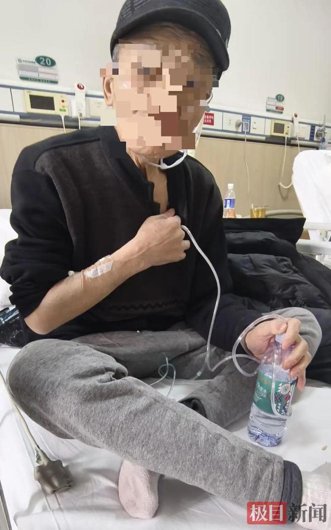武汉七旬老人呼吸困难,自行拿剪刀捅胸,胸腔插着自制引流管,连接矿泉水瓶“排气”,医生紧急提醒!