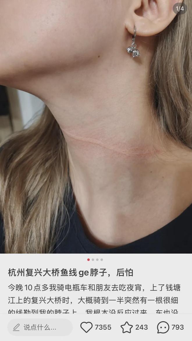 “真的后怕，根本反应不过来，线越勒越紧”，一女子夜骑，突然被细线勒住脖颈……
