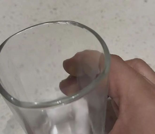 很受伤!上海男子海底捞用餐,疑似吞下玻璃碎片!5个多月未取出,又患“抑郁”