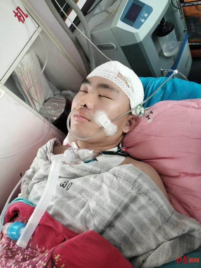 “23岁研究生被少年无证驾车撞致颅脑损伤”追踪:当地政府为其申办困难补助,爱心网友捐款相助